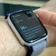 Apple Watch ECG