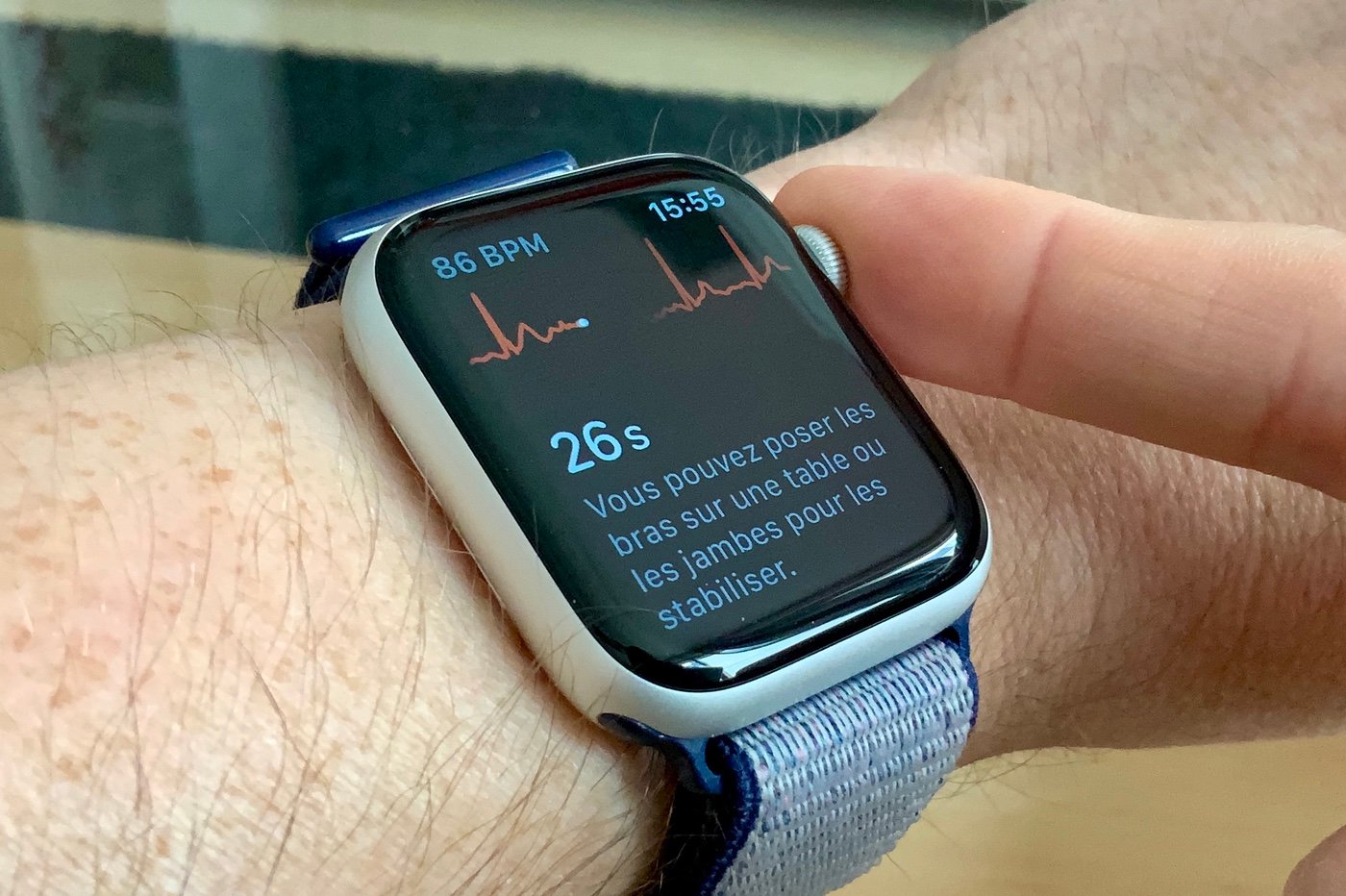 Apple Watch ECG