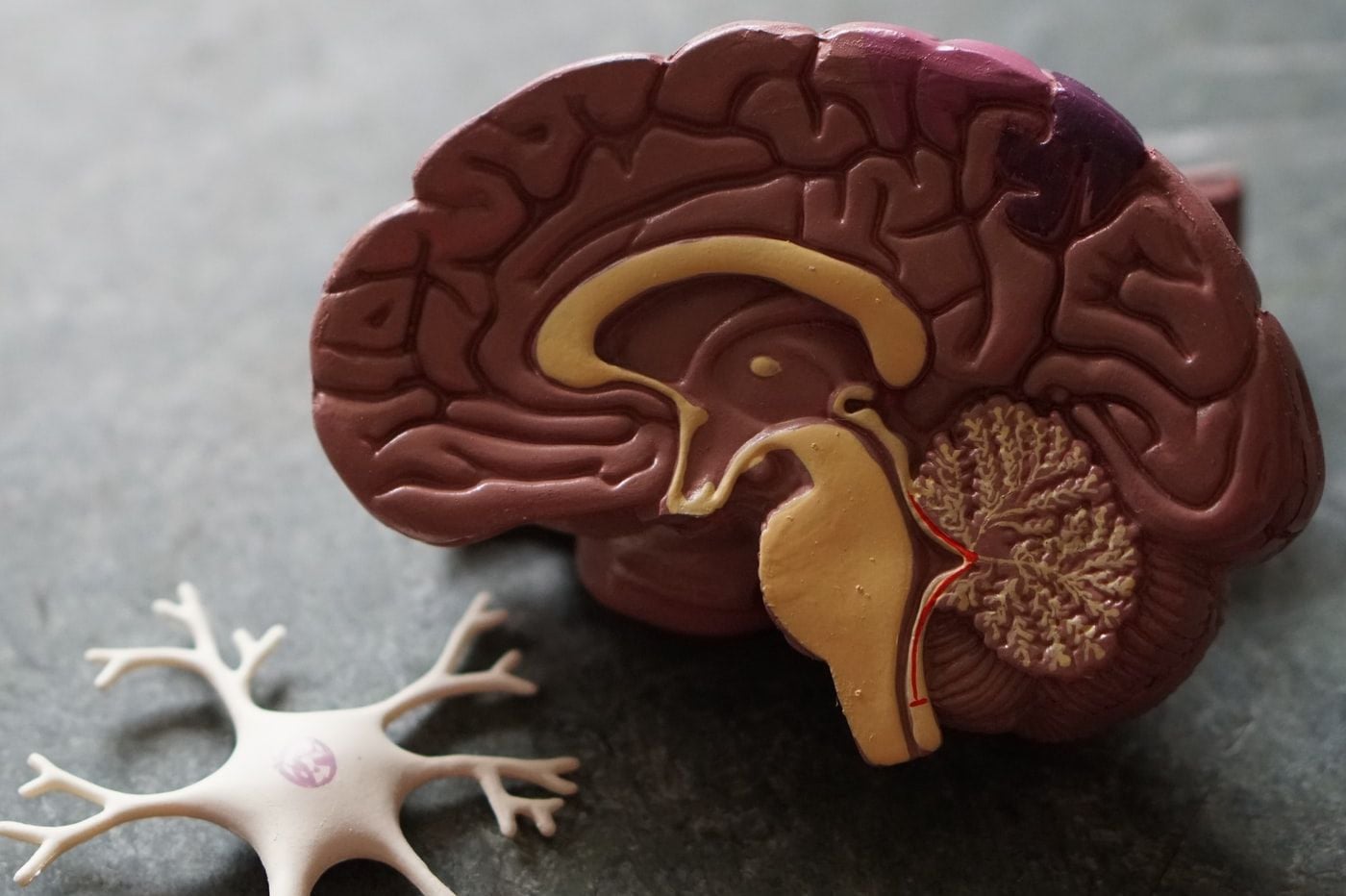 Coupe du cerveau