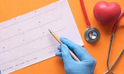 Coeur et ECG
