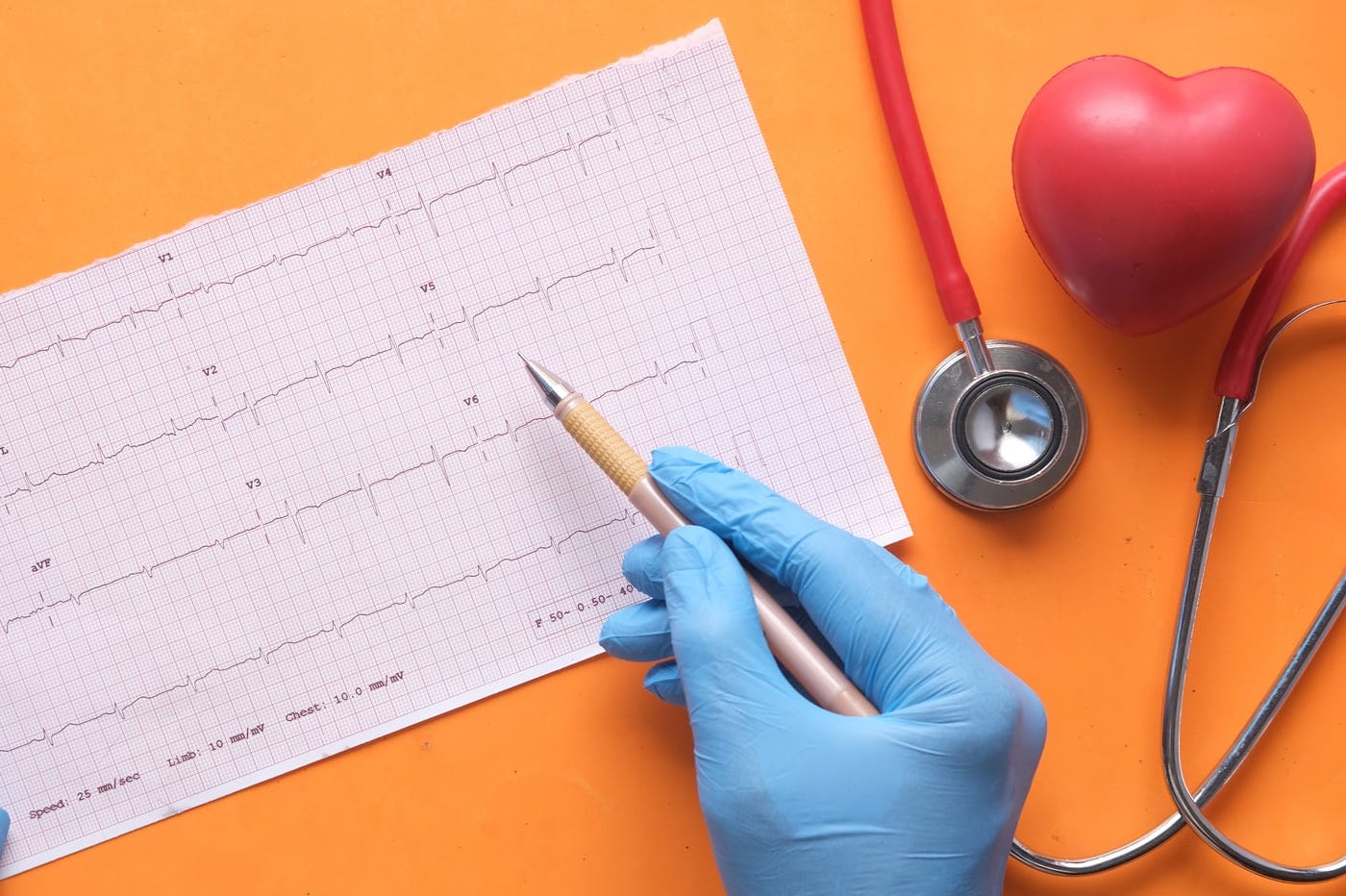 Coeur et ECG