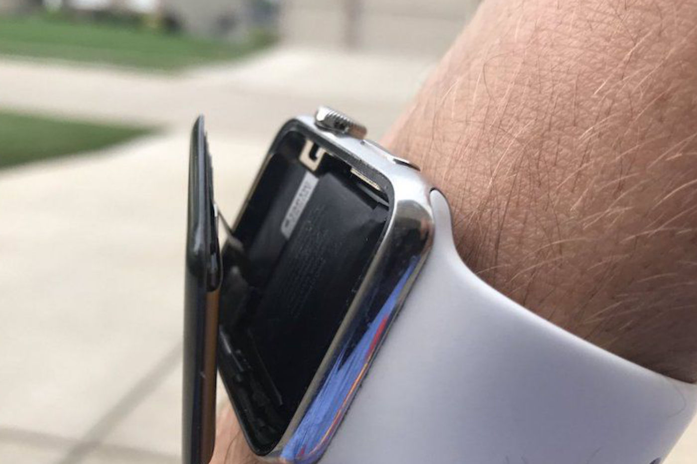 apple-watch-batterie-explosion