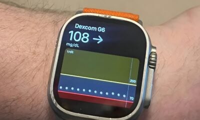 Dexcom apple watch diabete insuline