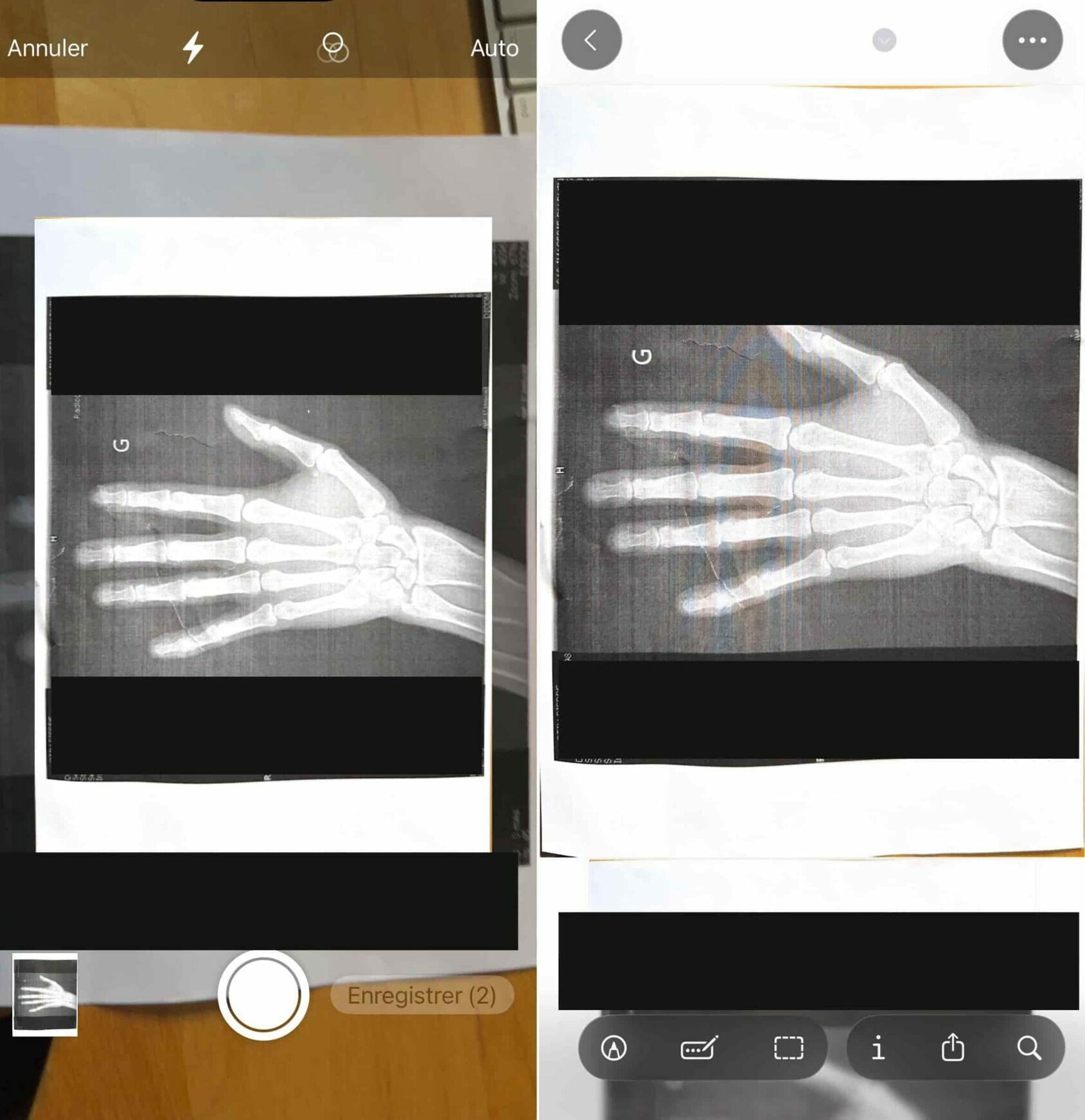 Aperçu iOS 26 scanner