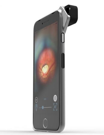 d-eye-iphone.jpg, 2011 d-eye-iphone.jpg
