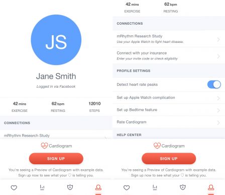 app-apple-watch-cardiogram-etude-maladie-coeur-3.jpg, 2017 app-apple-watch-cardiogram-etude-maladie-coeur-3.jpg