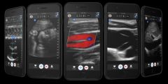 butterfly-iq-scanner-portable-echographie-iphone-1.jpg, 2017 butterfly-iq-scanner-portable-echographie-iphone-1.jpg