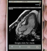 iPhone Médical