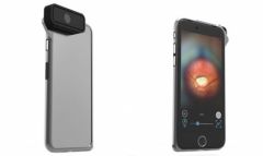 D-EYE-outil-d-examen-ophtalmologique-pour-iPhone.jpg, 2015 D-EYE-outil-d-examen-ophtalmologique-pour-iPhone.jpg